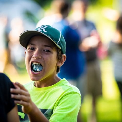 Comella Orthodontics Rochester New York Patient Candids 91 500x500 - Trevor's 13th Birthday Party!