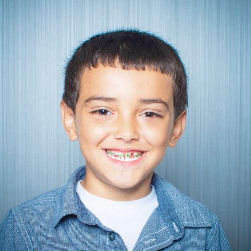 Comella Orthodontics Rochester New York Patient Portraits 5x5 17 500x500 - Invisalign