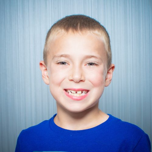 Comella Orthodontics Rochester New York Patient Portraits 5x5 25 500x500 - Clear Braces | Radiance