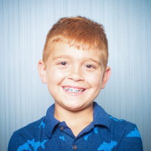 Comella Orthodontics Rochester New York Patient Portraits 5x5 300x300 - Our Smiles | Our Reviews