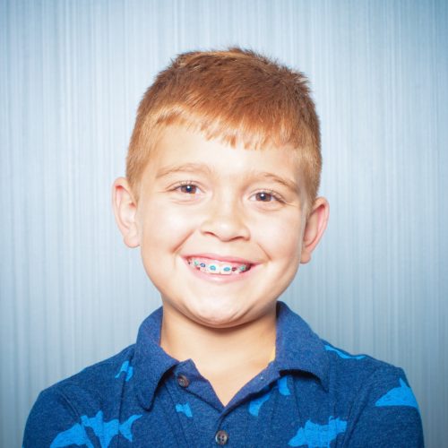 Comella Orthodontics Rochester New York Patient Portraits 5x5 500x500 - Clear Braces | Radiance