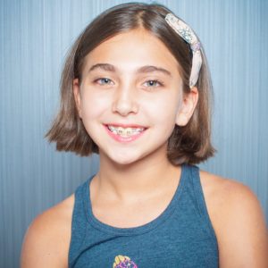 Comella Orthodontics Rochester New York Patient Portraits 8x10 23 300x300 - Our Smiles | Our Reviews