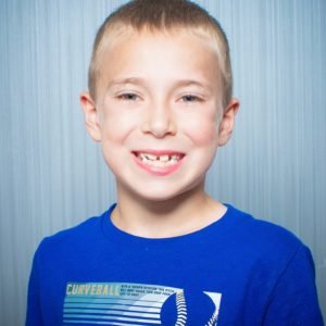 Comella Orthodontics Rochester New York Patient Portraits 8x10 27 300x300 - Our Smiles | Our Reviews