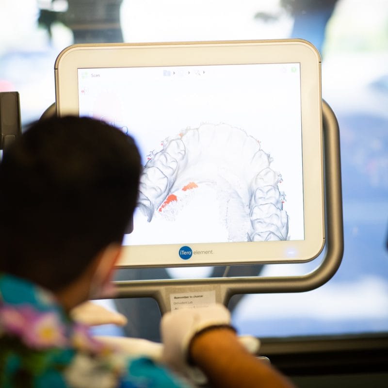 Comella Orthodontics Technology Rochester New York 28 800x800 - I Fell In Love with the Art and Science of a Beautiful Smile